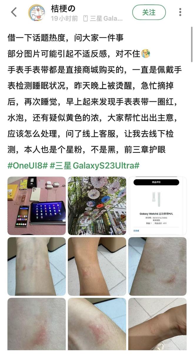 要选对材质佩戴方式也很重要智能手表导致皮肤红肿？不光(图2)