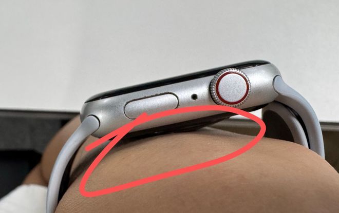 要选对材质佩戴方式也很重要智能手表导致皮肤红肿?不光(图8) 要选对材质佩戴方式也很重要智能手表导致皮肤红肿?不光(图8)