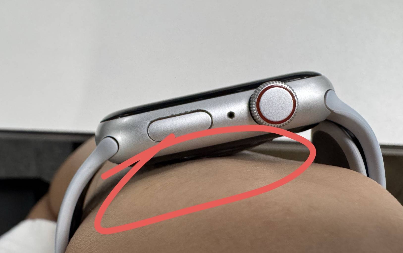 材质问题还是佩戴方式不对？三星手表再曝过敏事件！是(图6)